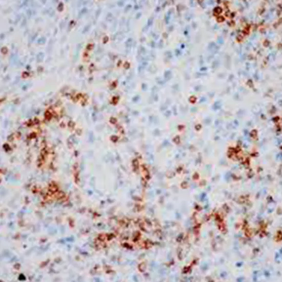 ihc - cluster of differentiation 3 (cd3)